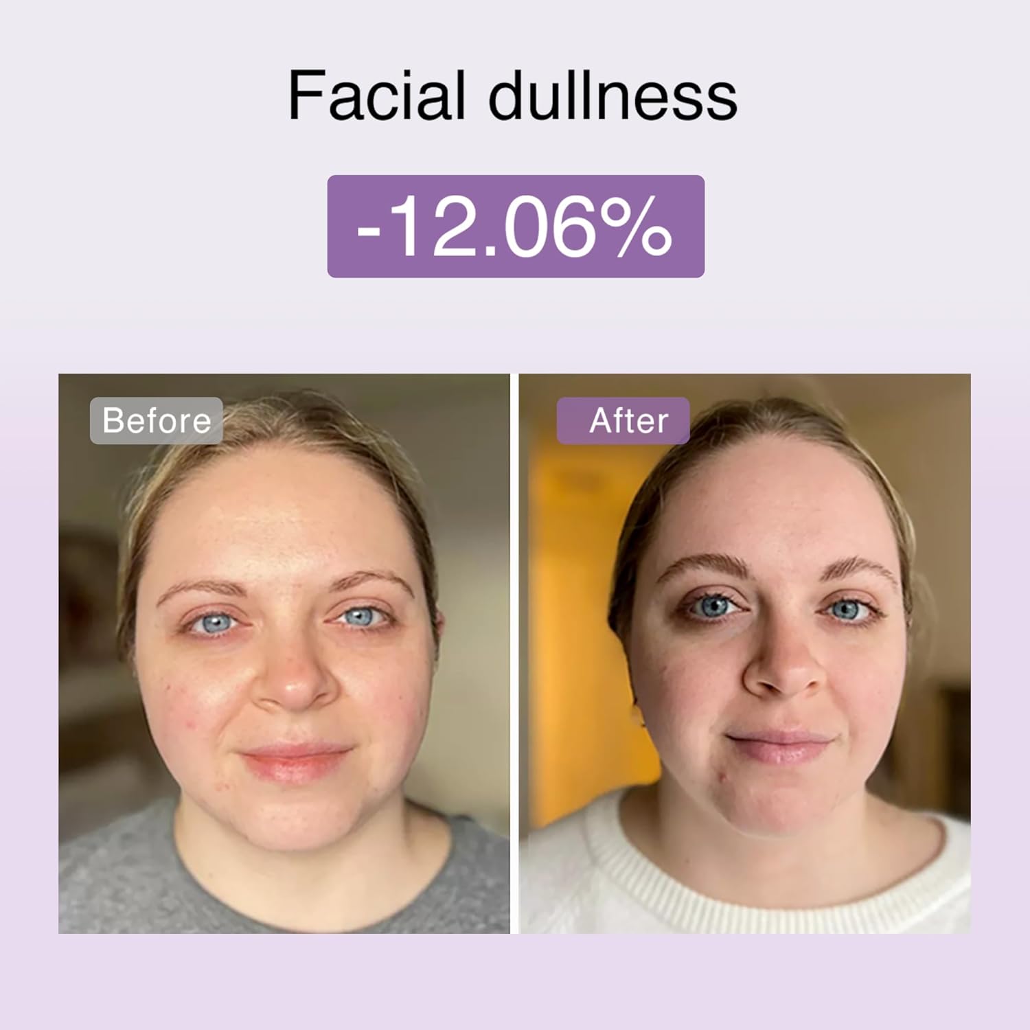 DermRays Cosmetics M1.4 Limo Little Face, LED-Rotlicht, LED-Geräte für Anti-Aging, Gesichtsstraffung, Falten, Brust und Ausstrahlung – Bild 12