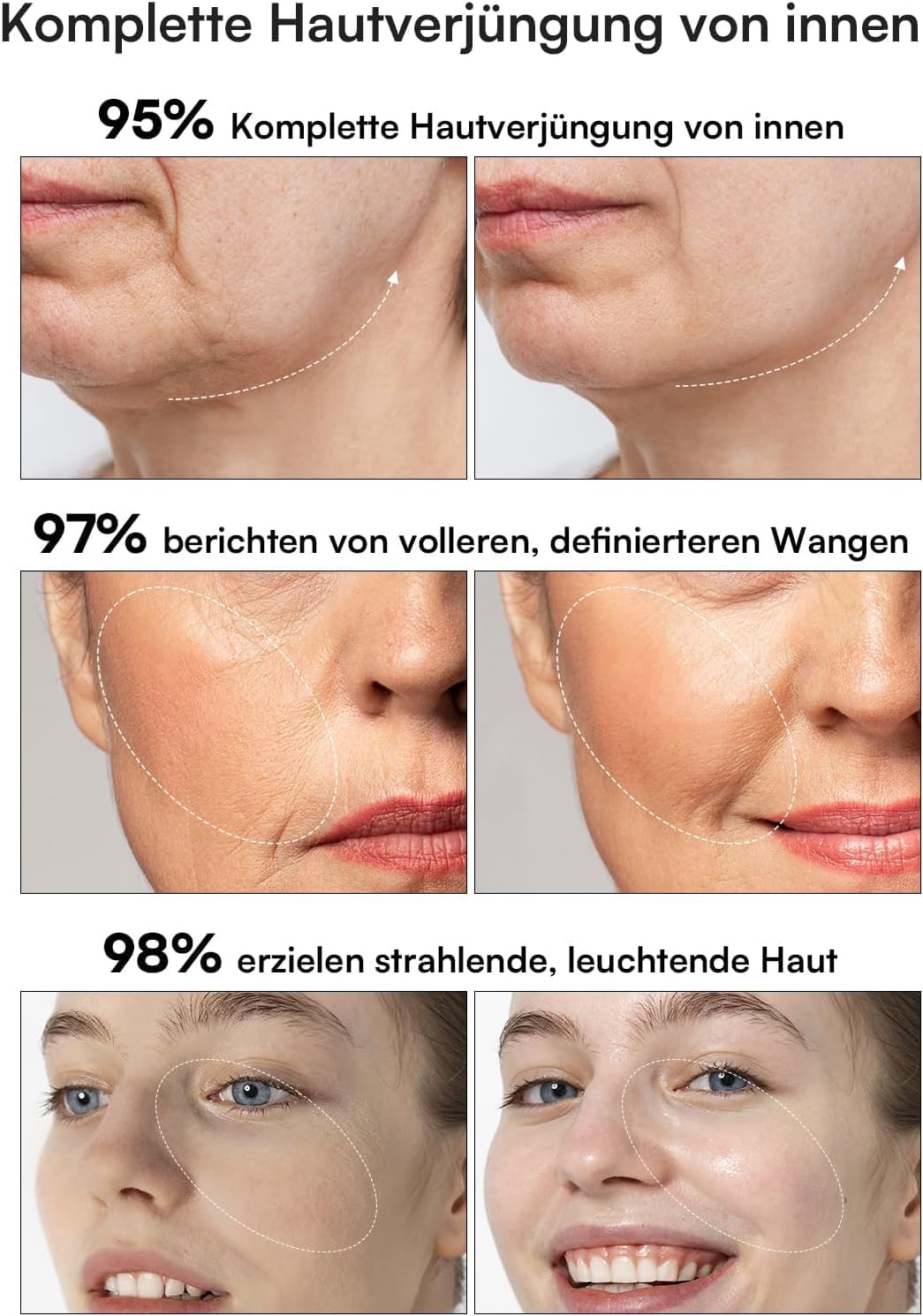 INIA Professionelles 3-in-1-Anti-Falten-Gesichtsmassagegerät mit Mikrostrom und rotem Licht, straffendes Lifting-Gerät für Hals/Nacken, reduziert Schwellungen und Falten – Bild 4