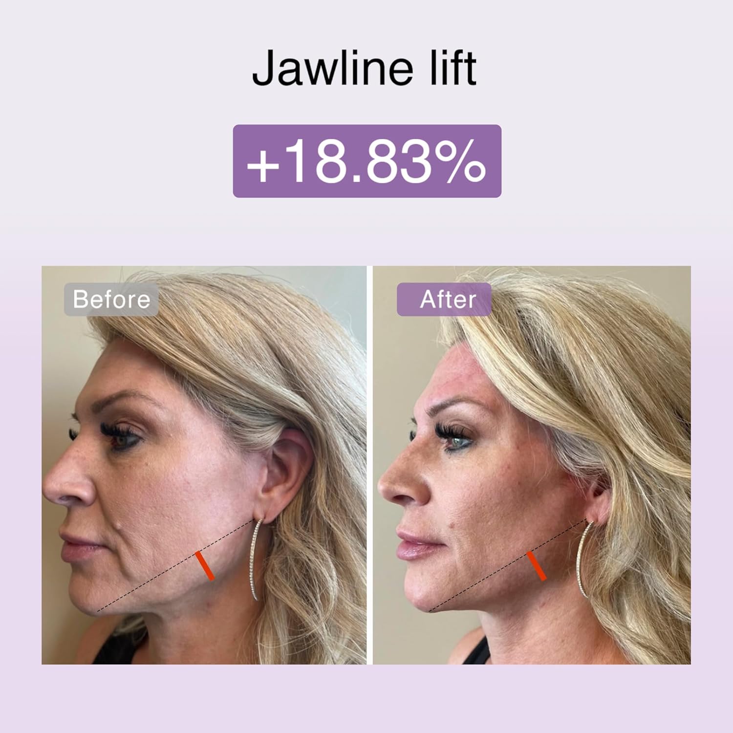 DermRays Cosmetics M1.4 Limo Little Face, LED-Rotlicht, LED-Geräte für Anti-Aging, Gesichtsstraffung, Falten, Brust und Ausstrahlung – Bild 9